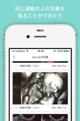 妊婦さんの為の妊娠応援アプリaomeey screenshot 2
