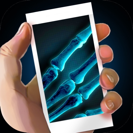 Simulator X-Ray Bone Fake iOS App