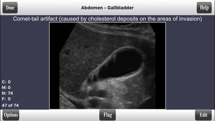 ARDMS Abdomen Ultrasound Flashcards for Boards