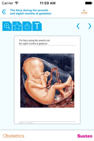 Mini Atlas Obstetrics screenshot 4