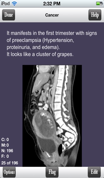 USMLE Step 1 Pathology Flashcards Liteのおすすめ画像2