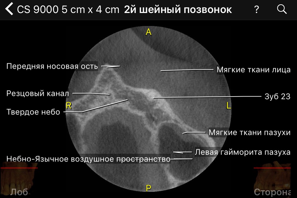 CBCT screenshot 2