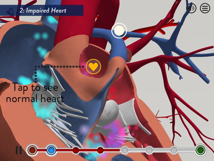 Child Heart Surgery screenshot-3