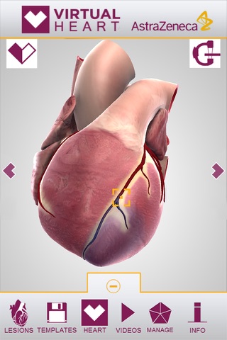 Virtual Heart - ANZ screenshot 2