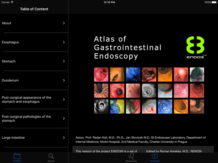 ENDO3®Atlas of GI Endoscopy HD