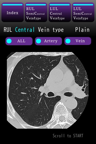 LungCT Anatomy STUDY iP screenshot 4