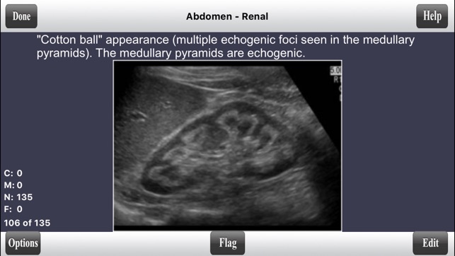 ARDMS Abdomen Ultrasound Flashcards for Boards(圖4)-速報App