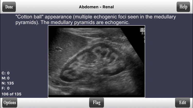 ARDMS Abdomen Ultrasound Flashcards for Boards screenshot-3
