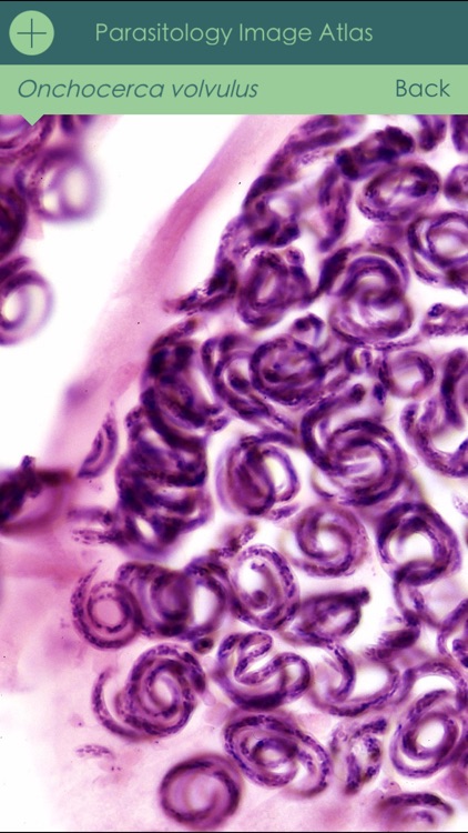 Parasitology Image Atlas