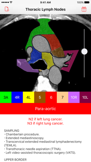 Thoracic Lymph Node Map(圖3)-速報App