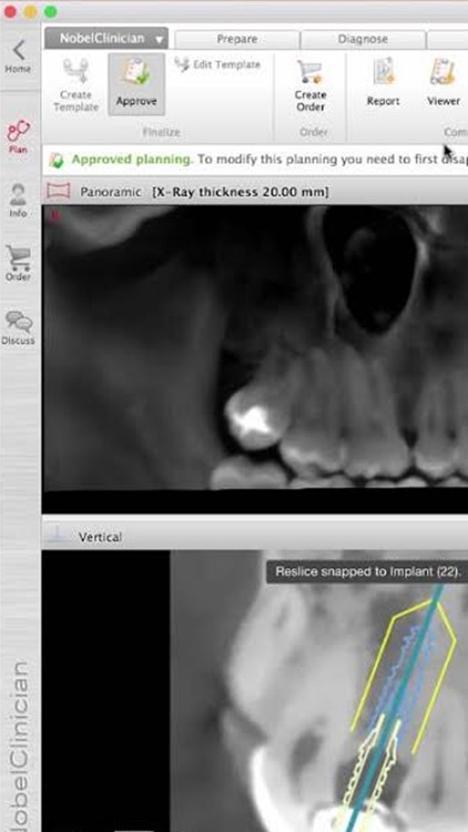 NobelClinician® Tutorial