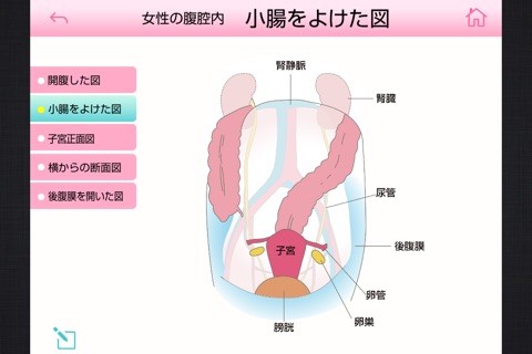専門医の医学図典　婦人科手術 screenshot 3