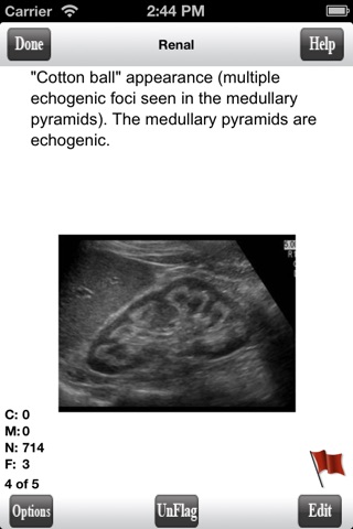 ARDMS Abdomen Ultrasound Flashcards for Boards screenshot 3