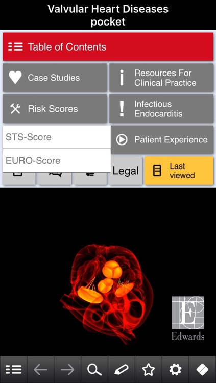 Valvular Heart Diseases pocket