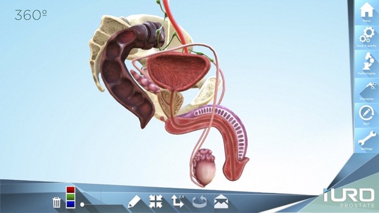 iURO Prostate screenshot-4