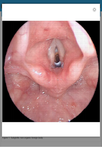 ENT Surgery Atlas screenshot 3