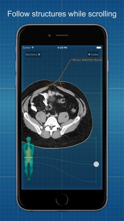 X-Anatomy Basic screenshot-2