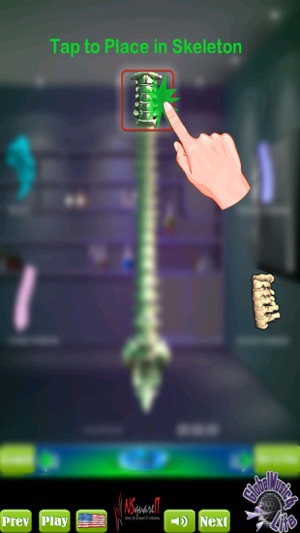 GM4L Spine Bone Game(圖2)-速報App