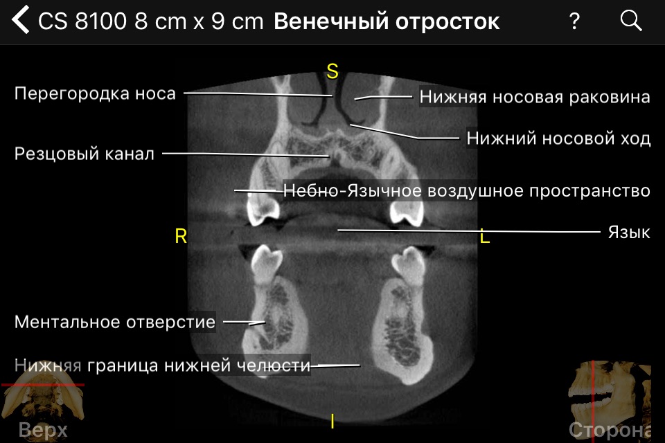 CBCT screenshot 3