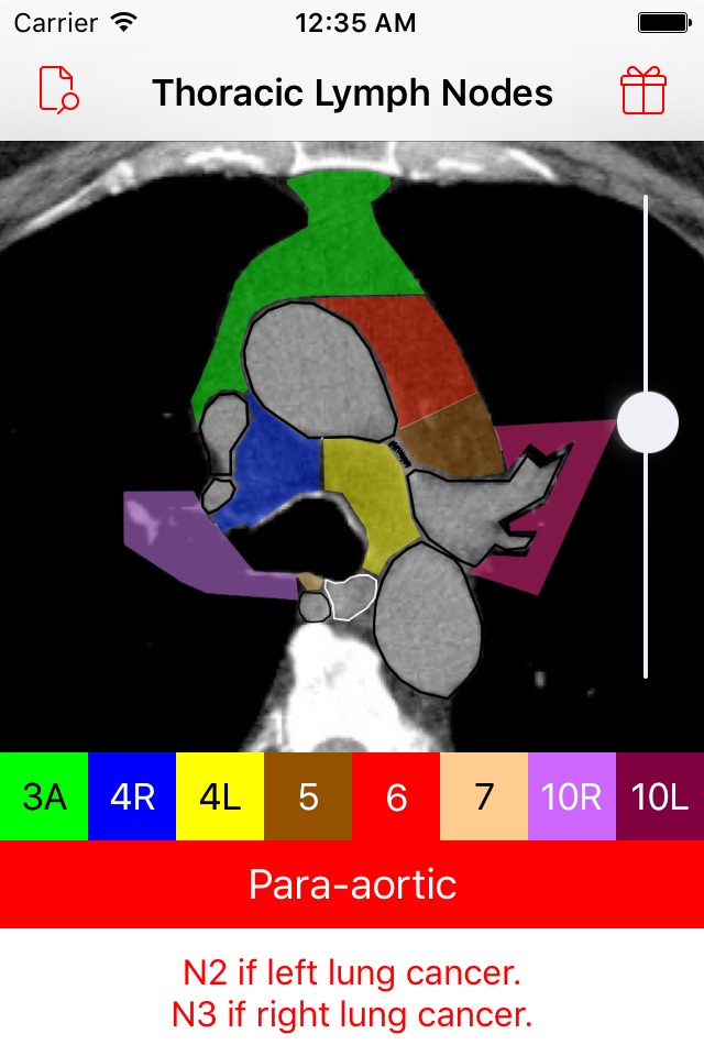 Thoracic Lymph Node Map screenshot 2