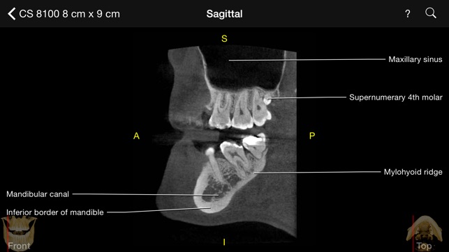 CBCT(圖1)-速報App