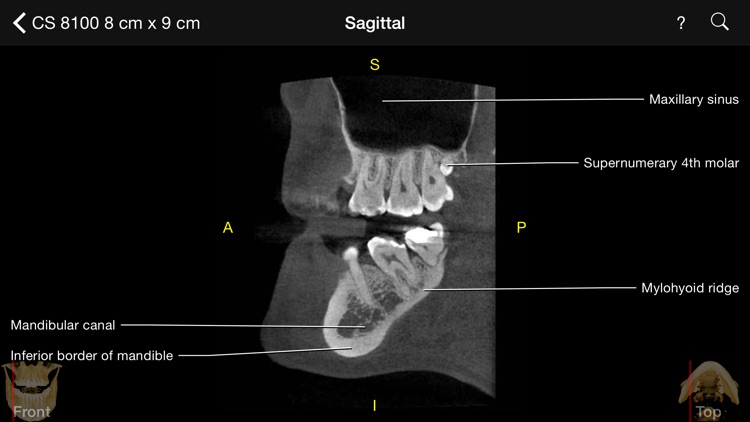 CBCT