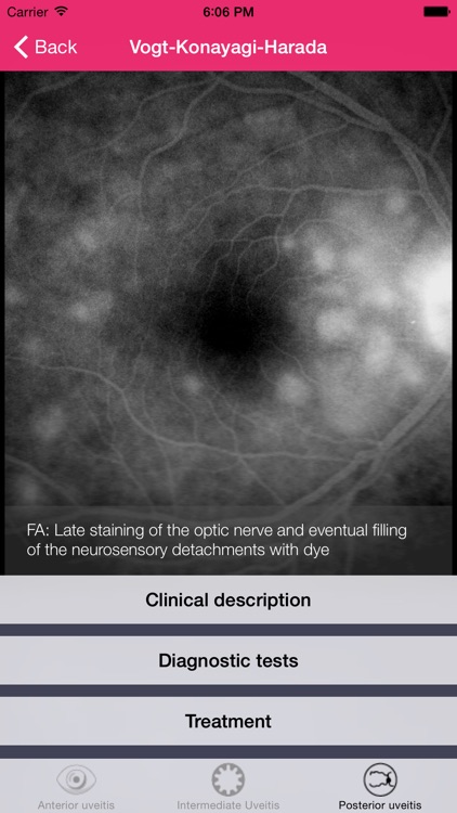 Uveitis doctor