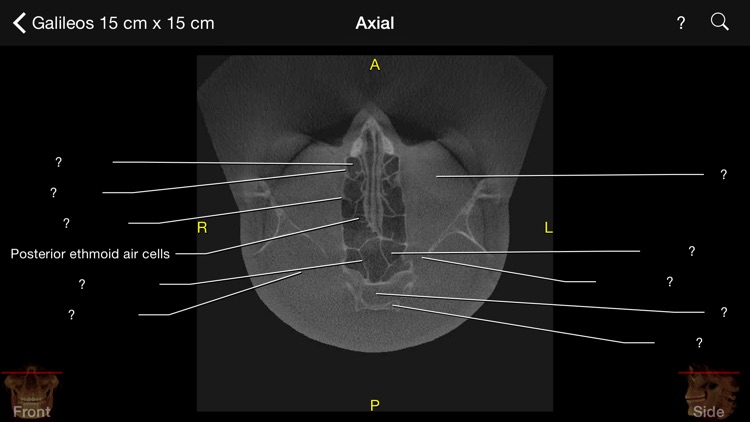 CBCT screenshot-4