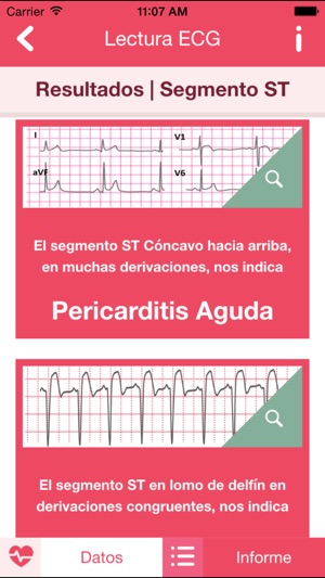 ECG Práctico(圖3)-速報App