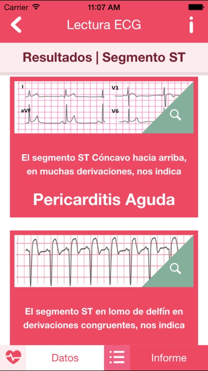 ECG Práctico