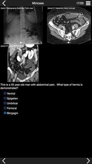 QEVLAR Radiology