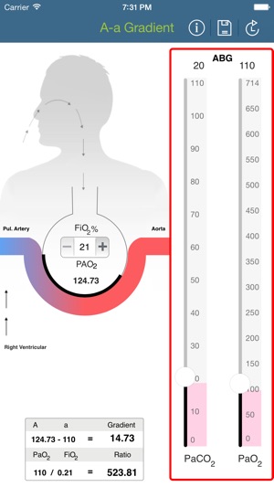 Alveolar - arterial (A-a) Gradient(圖1)-速報App