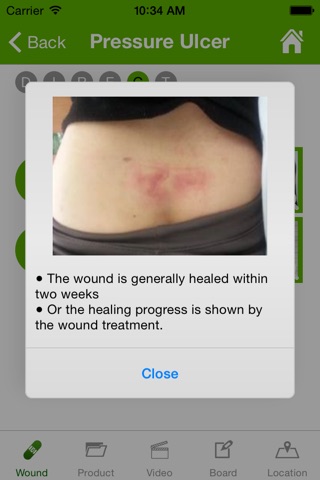 D+Wound Solution screenshot 2