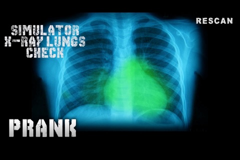 Simulator X-Ray Lungs Check screenshot 2