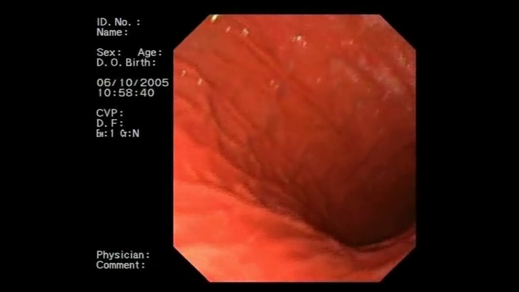 ENDO3® Atlas of Gastrointestinal Endoscopy - Lite screenshot-4