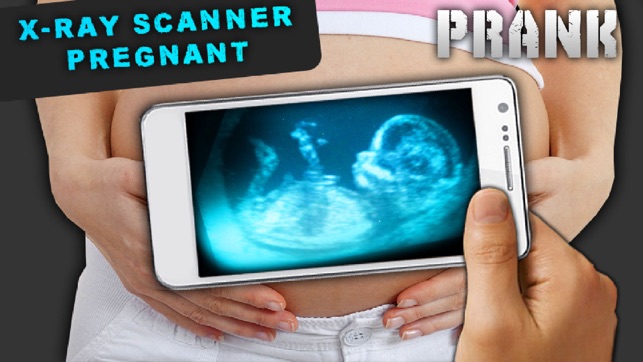 Simulator X-Ray Pregnant(圖2)-速報App