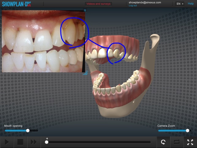 Showplan-DX - Dental(圖4)-速報App