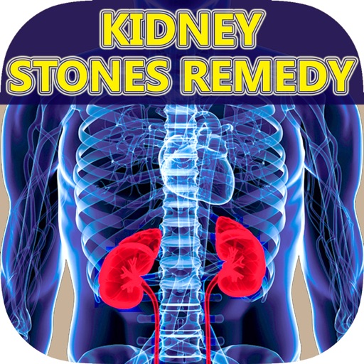 A+ Facts Of Kidney Stones - Best Guide To Find Out Kidney Stone Symptoms, Signs, Causes, Pain, Treatments & Natural Remedy Icon