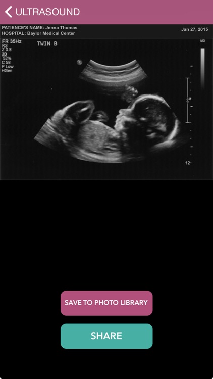 My Ultrasound: Prank App