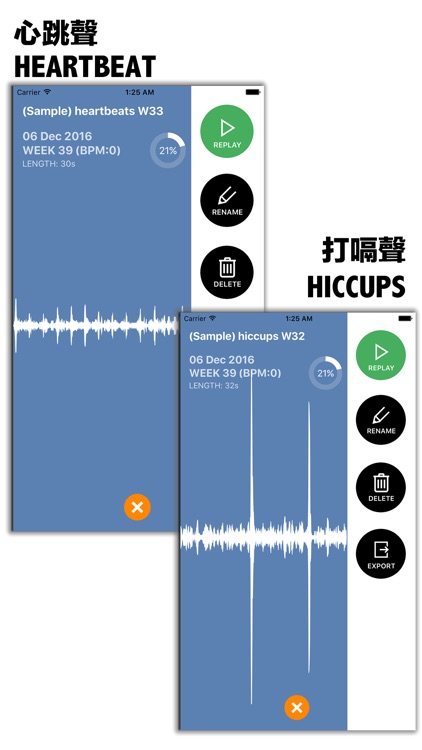 Baby Beat - Baby Heartbeat Visualiser