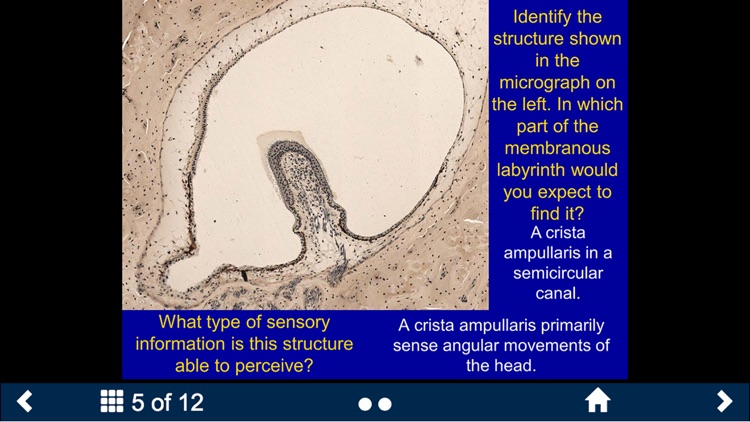 Histology - Nervous System screenshot-4
