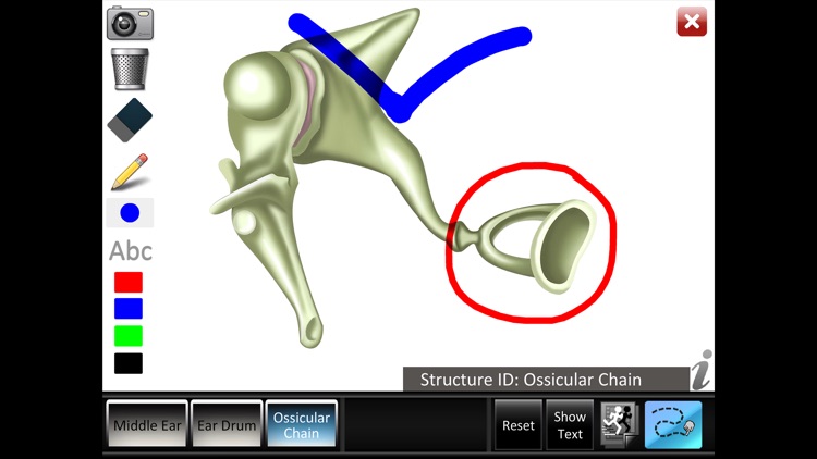 Middle Ear ID screenshot-3