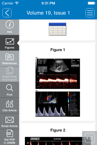 Australasian Journal of Ultrasound Medicine screenshot 2