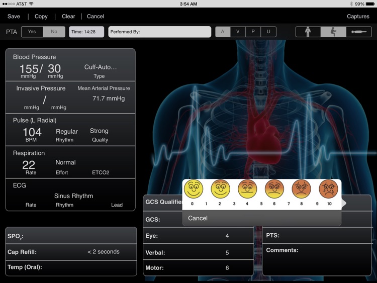 iPCR Insight screenshot-3