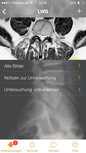 DIE RADIOLOGIE(圖3)-速報App