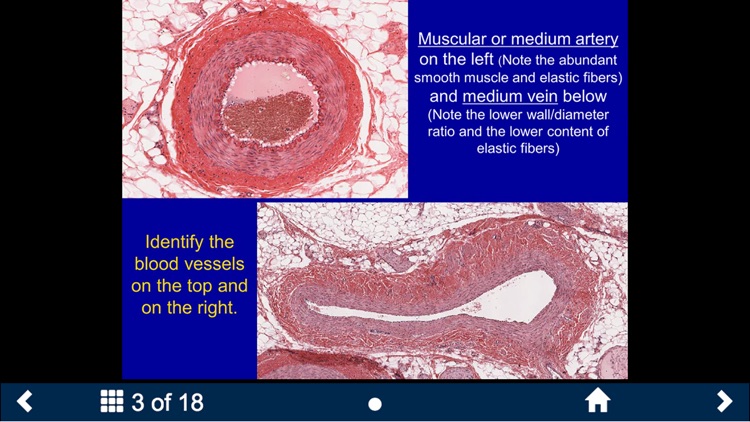 Histology - Cardiovascular and Lymphatic System