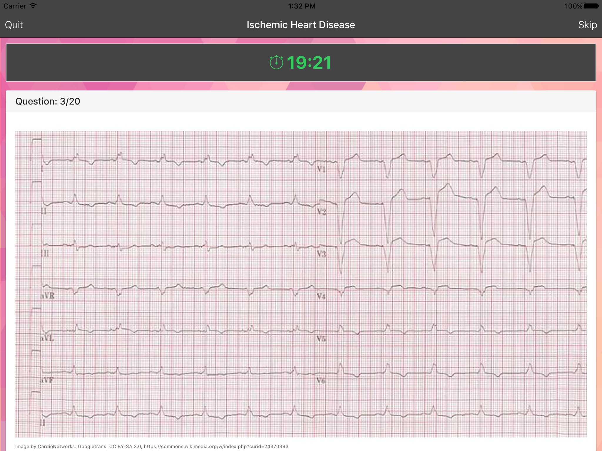 ECG Master - Quiz, Exam, Explanation, Statistic screenshot 3