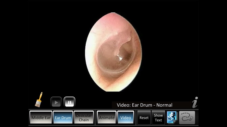 Middle Ear ID screenshot-4