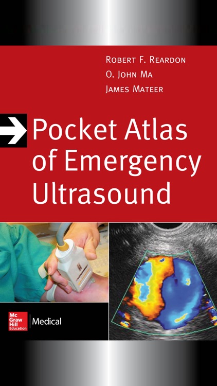 Pocket Atlas of Emergency Ultrasound