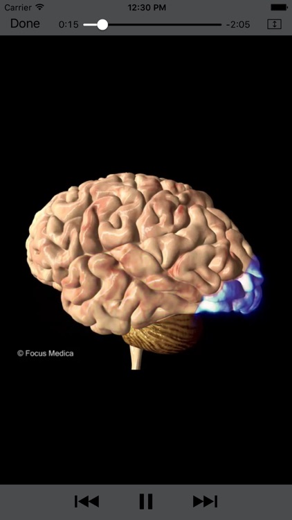 Neurology - Understanding Disease screenshot-3